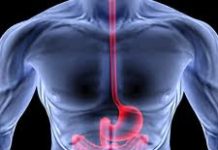 Các phương pháp điều trị bệnh CROHN