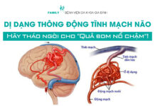 Dị dạng thông động tĩnh mạch não