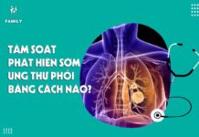 Tầm soát phát hiện sớm ung thư phổi bằng cách nào?