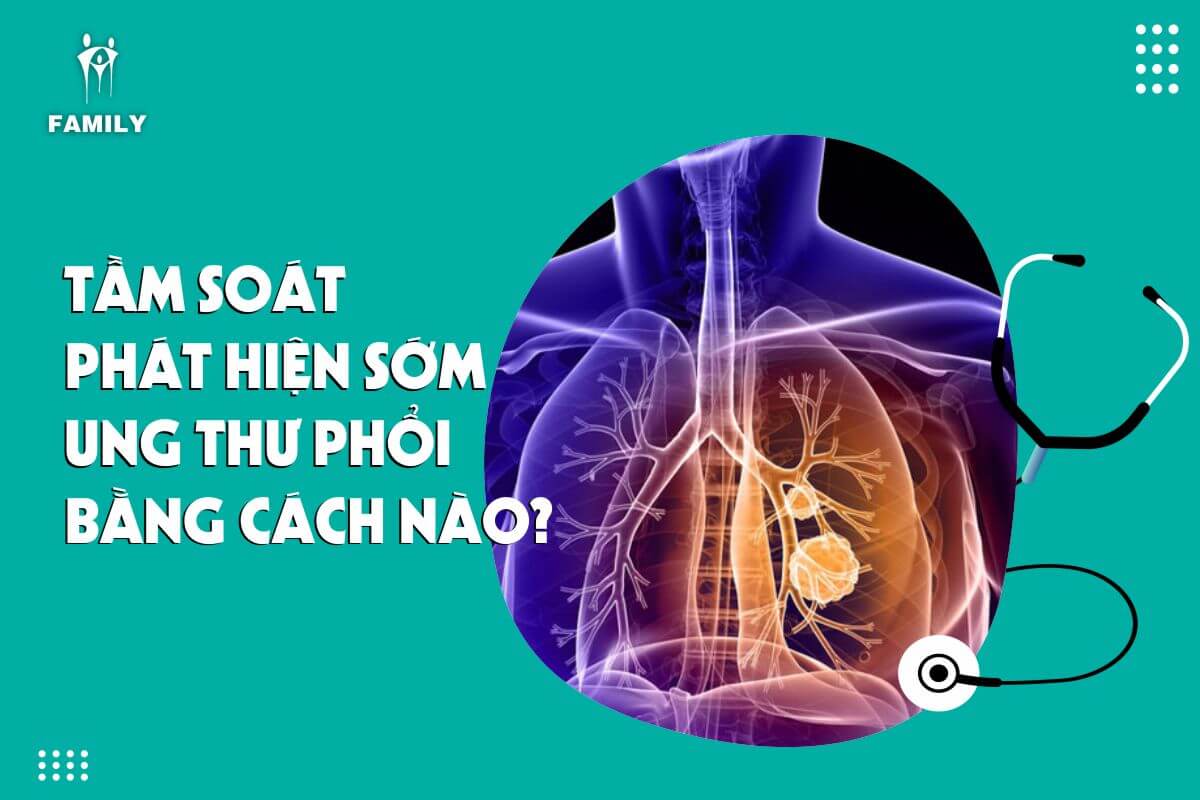 Xét nghiệm đờm cũng có vai trò như thế nào trong sàng lọc ung thư phổi?
