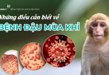 Những điều cần biết về bệnh đậu mùa khỉ