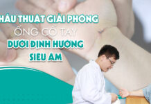 Phẫu thuật giải phóng ống cổ tay dưới định hướng của siêu âm