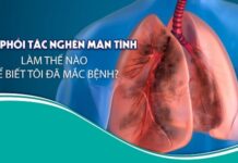 Bệnh phổi tắc nghẽn mạn tính: Làm thế nào để biết tôi đã mắc bệnh?