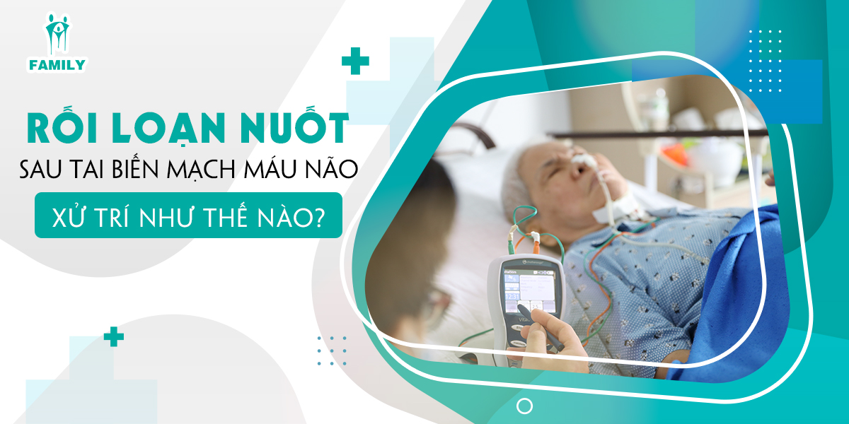 5. Phương pháp chẩn đoán và đánh giá rối loạn nuốt