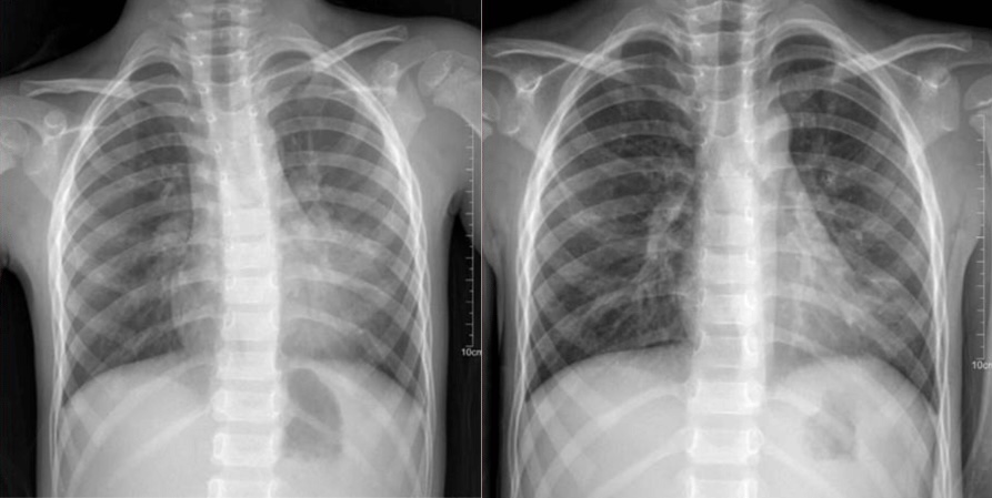 Ảnh X-quang của bệnh nhân