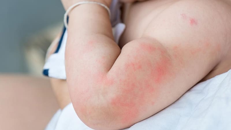 may_day_phat_ban_o_tre