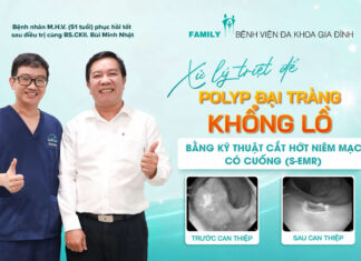 Xử lý polyp đại tràng khổng lồ bằng kỹ thuật cắt hớt niêm mạc có cuống qua nội soi (S-EMR)